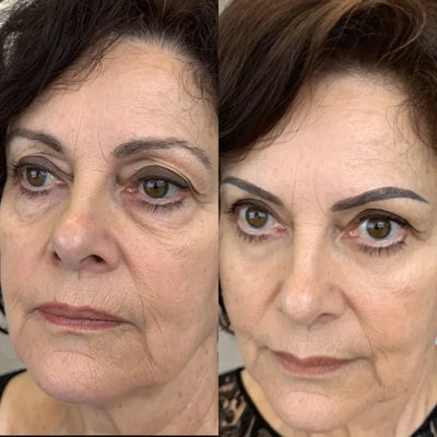 RevitalEyes® 2 en 1: terapia de luz roja + EMS para eliminar las bolsas de los ojos.